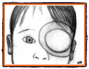 Ambliopia un test pentru ochii copiilor nostri